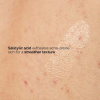 The Ordinary Salicylic Acid 0.5% Body Serum