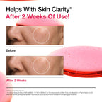 Niacinamide 10 TXA 4 Serum for Brightening and Dark Spots